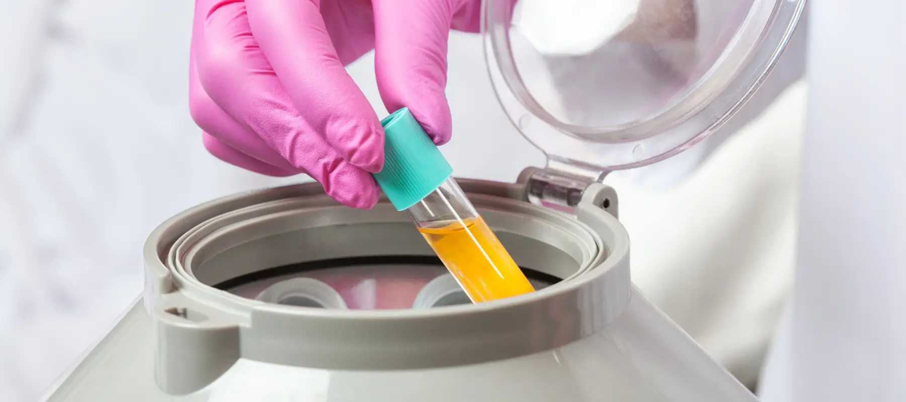 platelet rich plasma prp by ritucci regenerative medicine